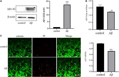 Exosomes Derived From M2 Microglia Cells Attenuates Neuronal Impairment and Mitochondrial Dysfunction in Alzheimer’s Disease Through the PINK1/Parkin Pathway